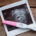 Ultrasound and positive pregnancy test
