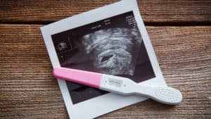 Ultrasound and positive pregnancy test