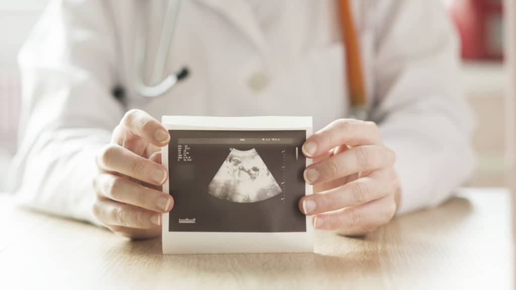 A photo of an ultrasound explaining facts stats and research about abortion.