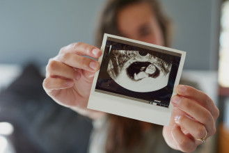Woman holding photo of ultrasound
