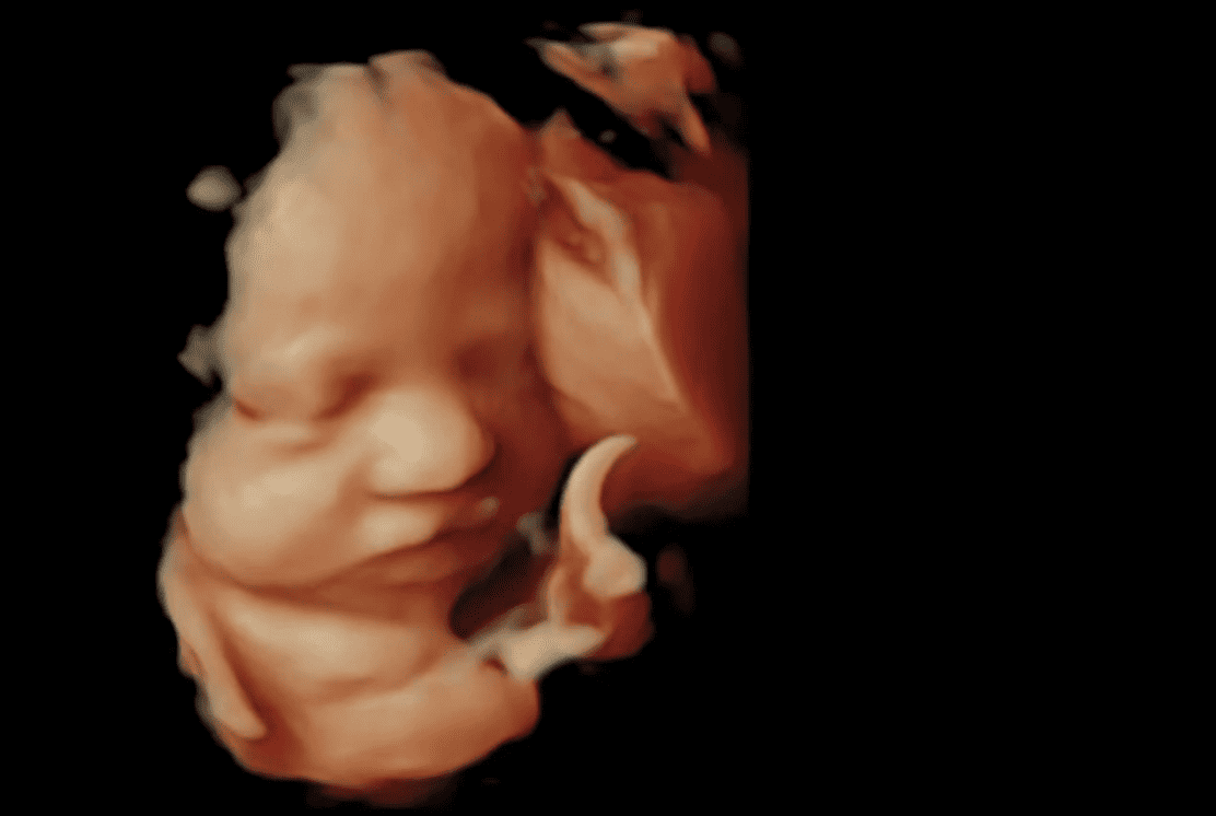 A 3D Ultrasound image of a preborn baby in the womb.
