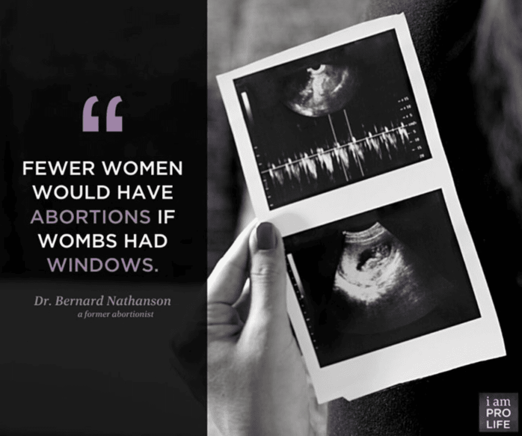 An ultrasound image and quote disproves the pro-choice argument. An ultrasound image and quote disproves the pro-choice argument.