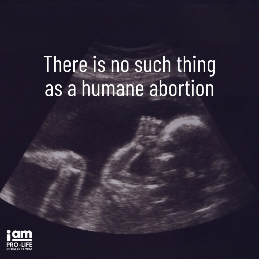 "I Thought I Was Pro-Life Until I Saw an Ultrasound" article graphic with an image of a baby on an ultrasound and words that read, "there's no such thing as a humane abortion."