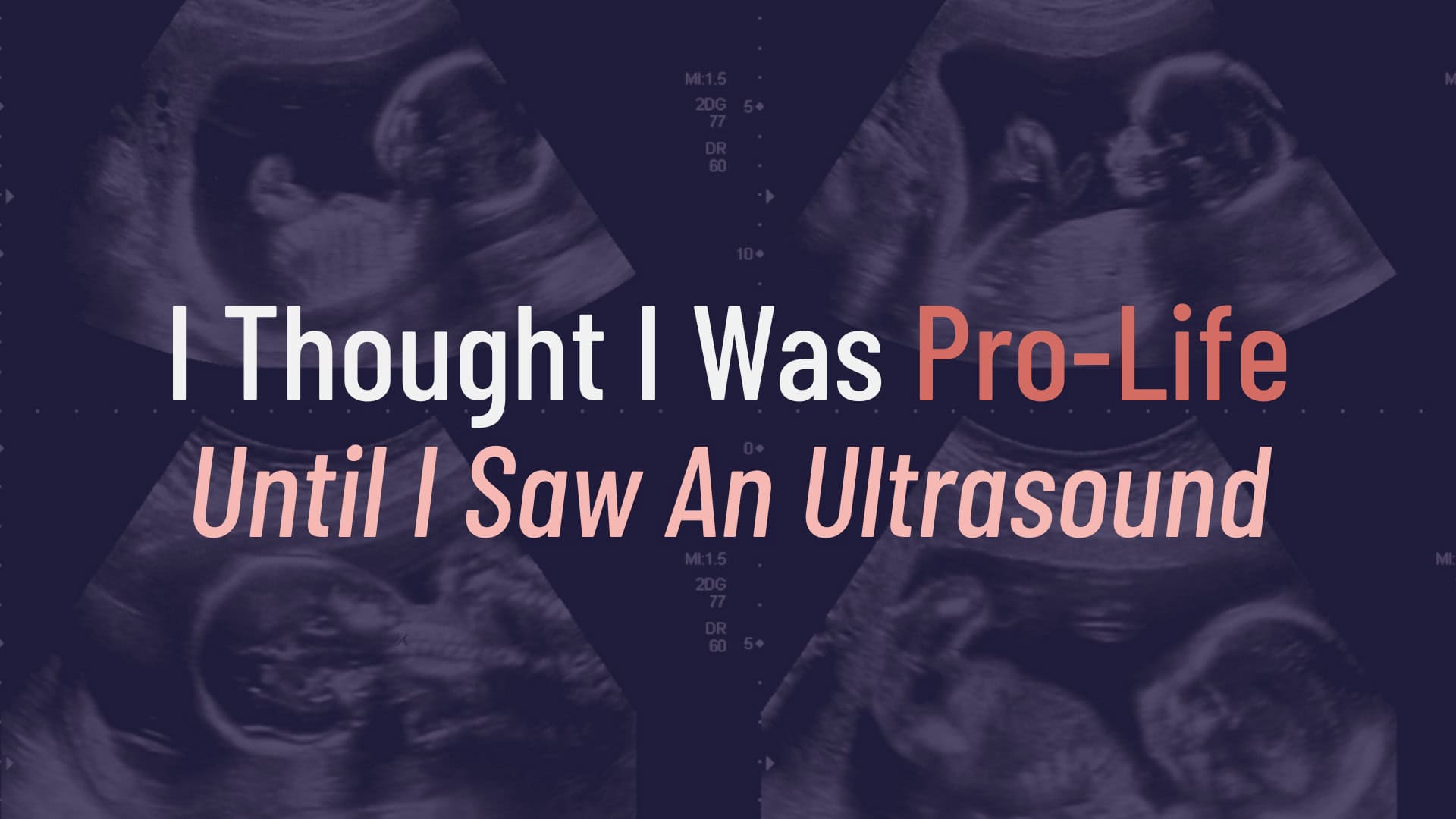 "I Thought I Was Pro-Life Until I Saw an Ultrasound" hero image with images of ultrasounds and the title of the article