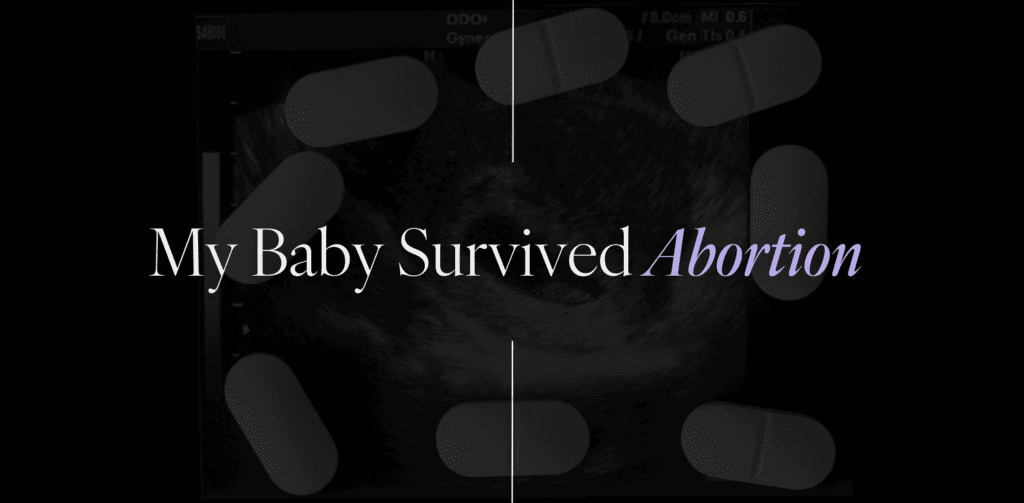 My baby survived abortion in my failed abortion.