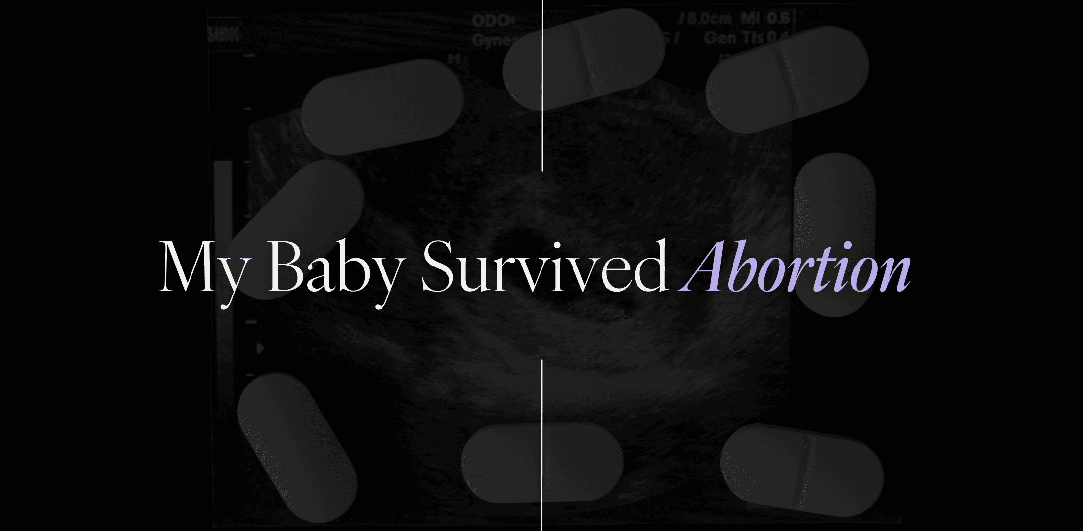 My baby survived abortion in my failed abortion.