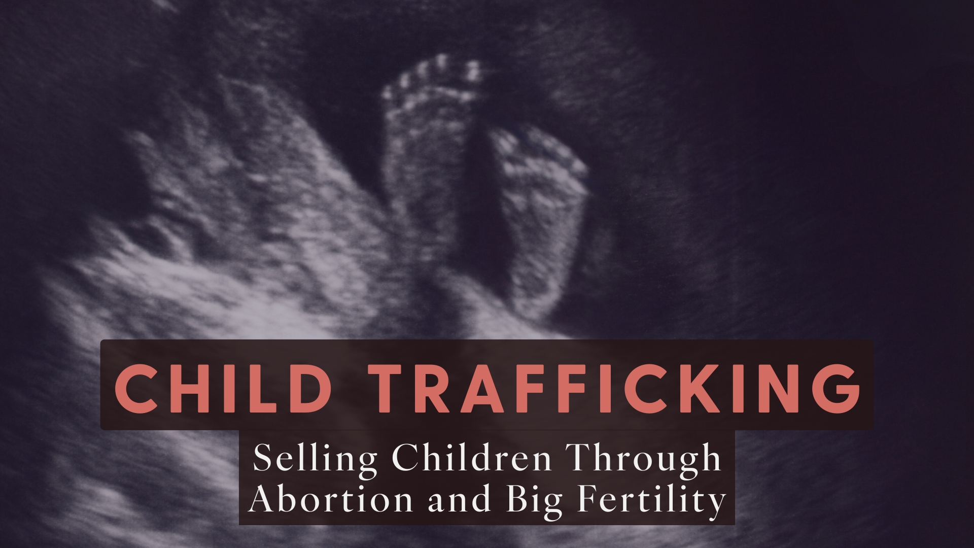 "Child Trafficking: Selling Children Through Abortion and Big Fertility" hero image with a picture of a preborn child's feet via ultrasound and the title.