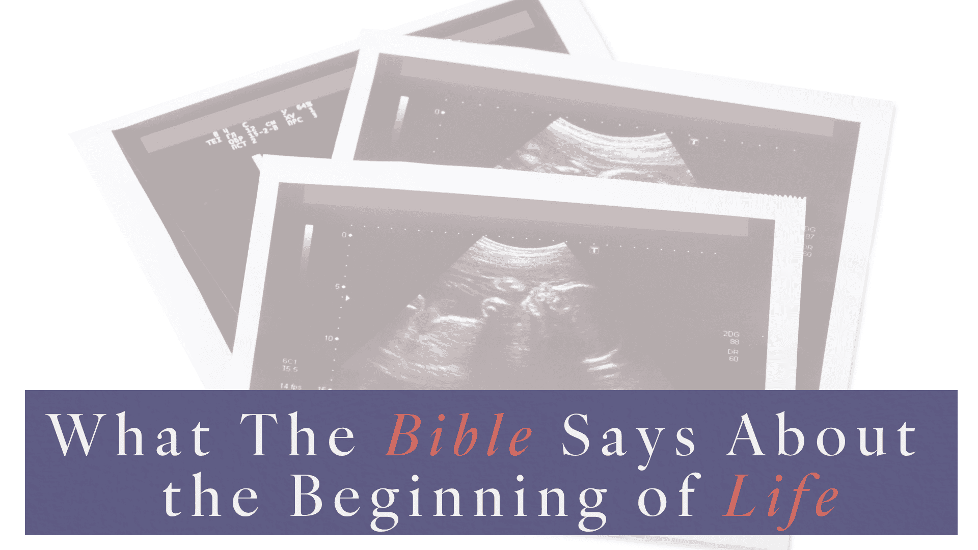 Picture of ultrasound pictures and title What the Bible Says About the Beginning of Life